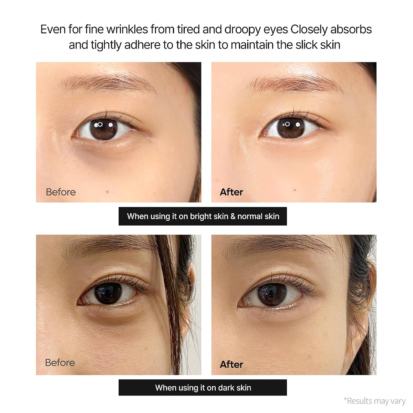 Calcium Dark Spot Cream