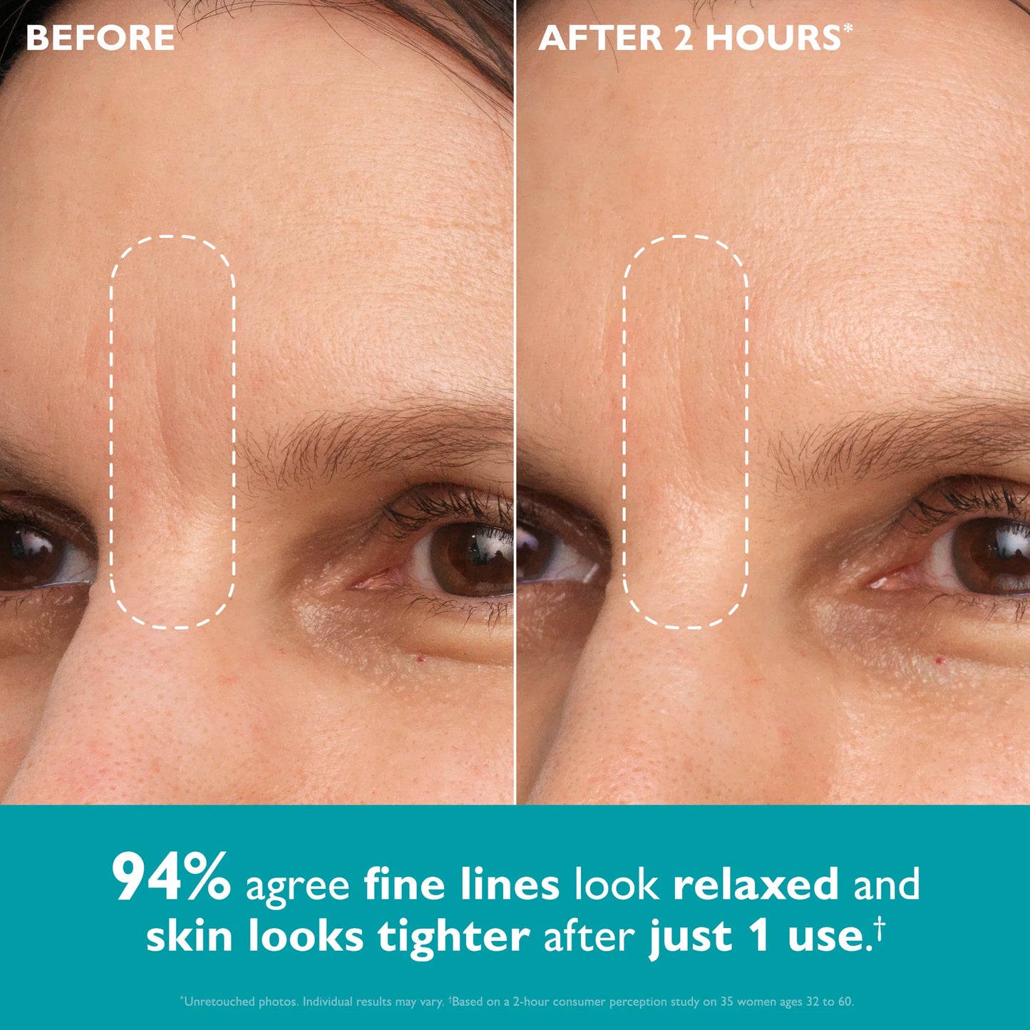 Peptide Infused Face + Eye Tape