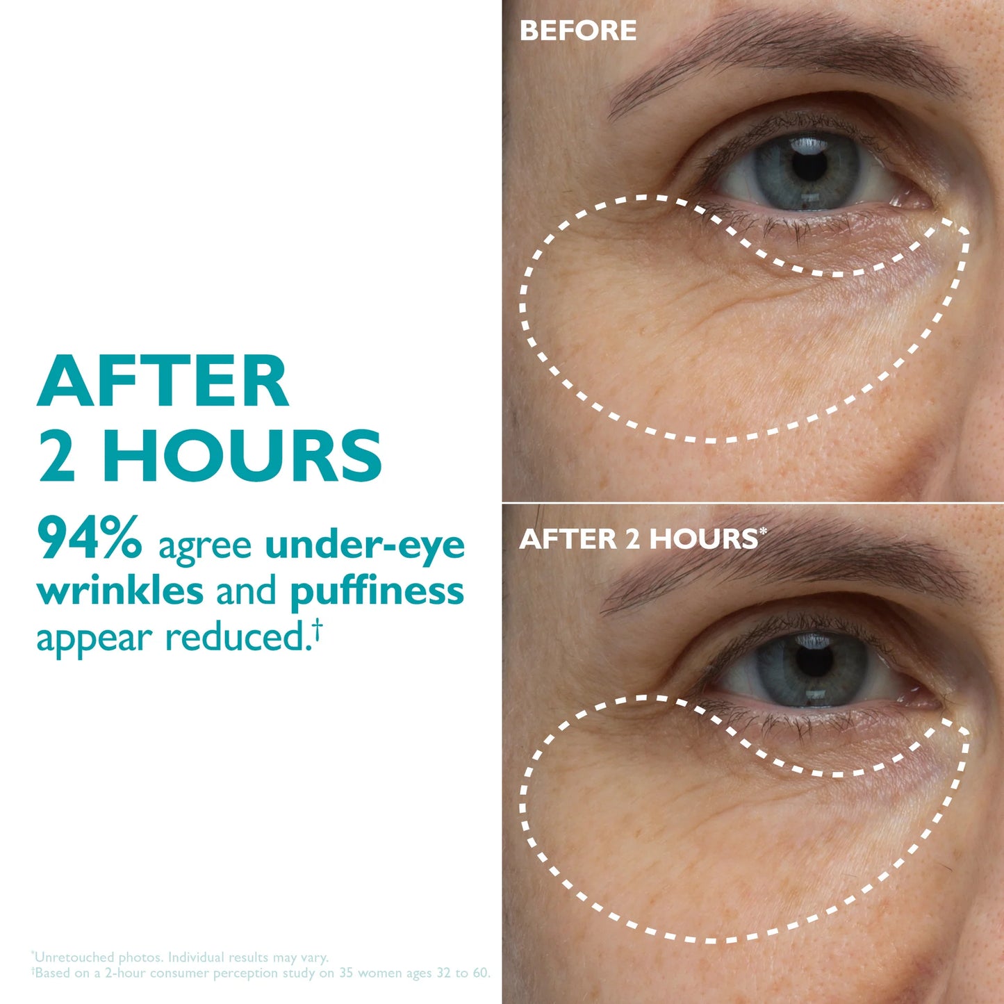 Peptide Infused Face + Eye Tape